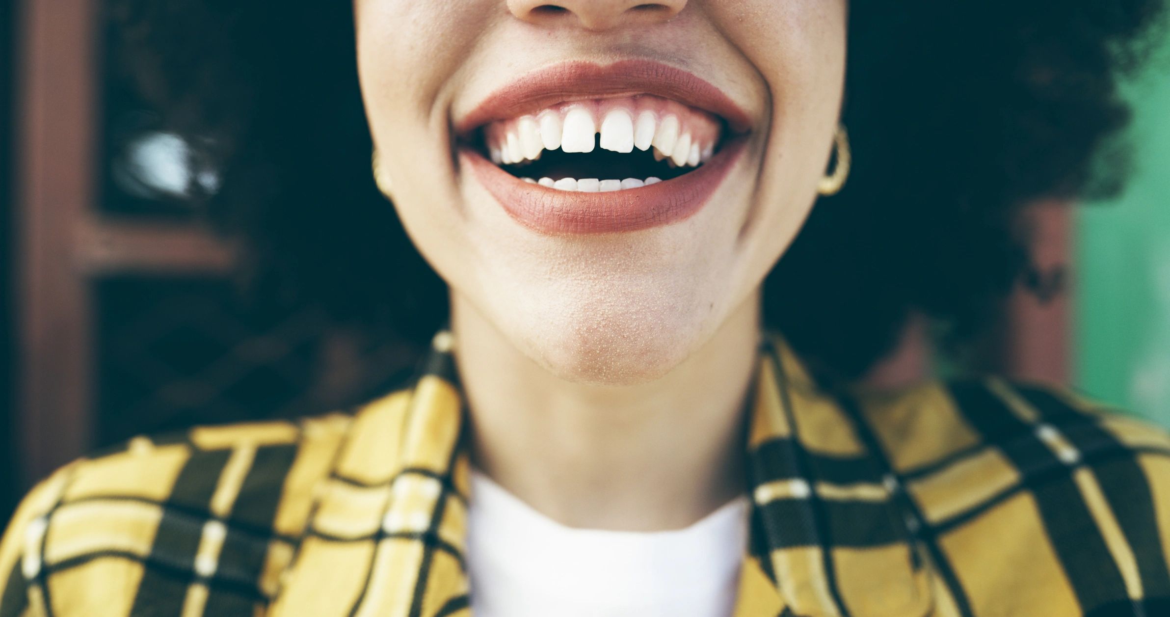 Smiling client suitable for tooth gem service