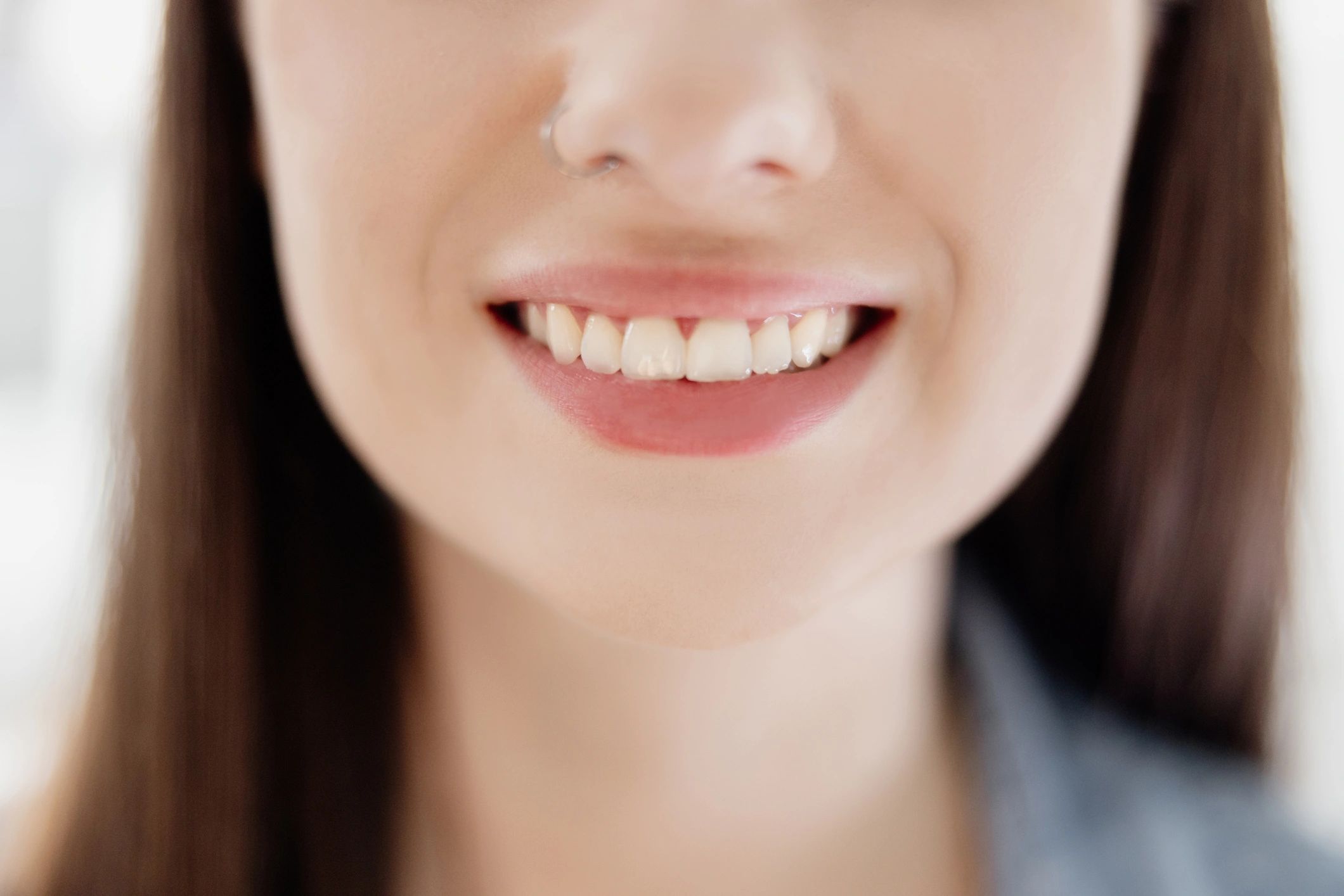 Close-up smile representing tooth gems and whitening services